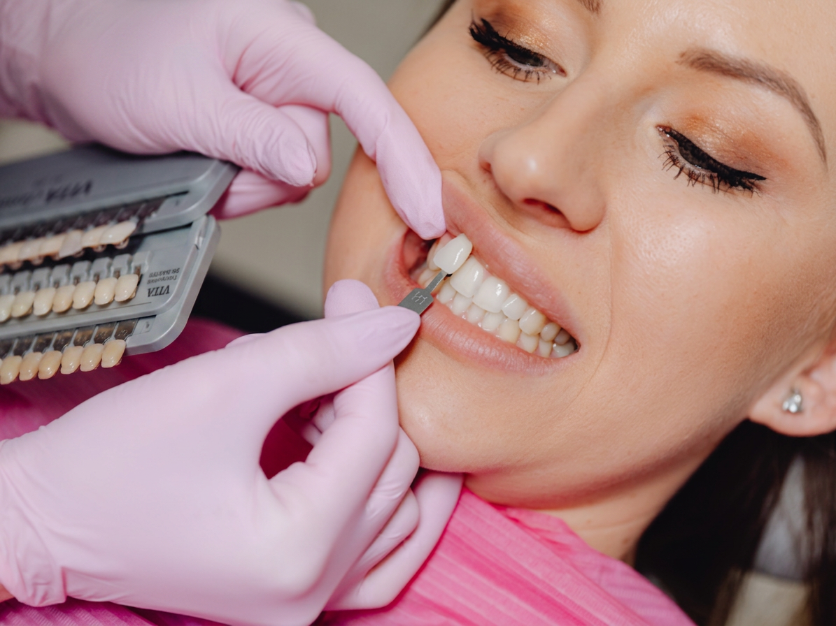 Dental veneers Hamilton, cosmetic dentist matching a porcelain veneer shade against a patient's natural teeth at Charlton Dentistry.