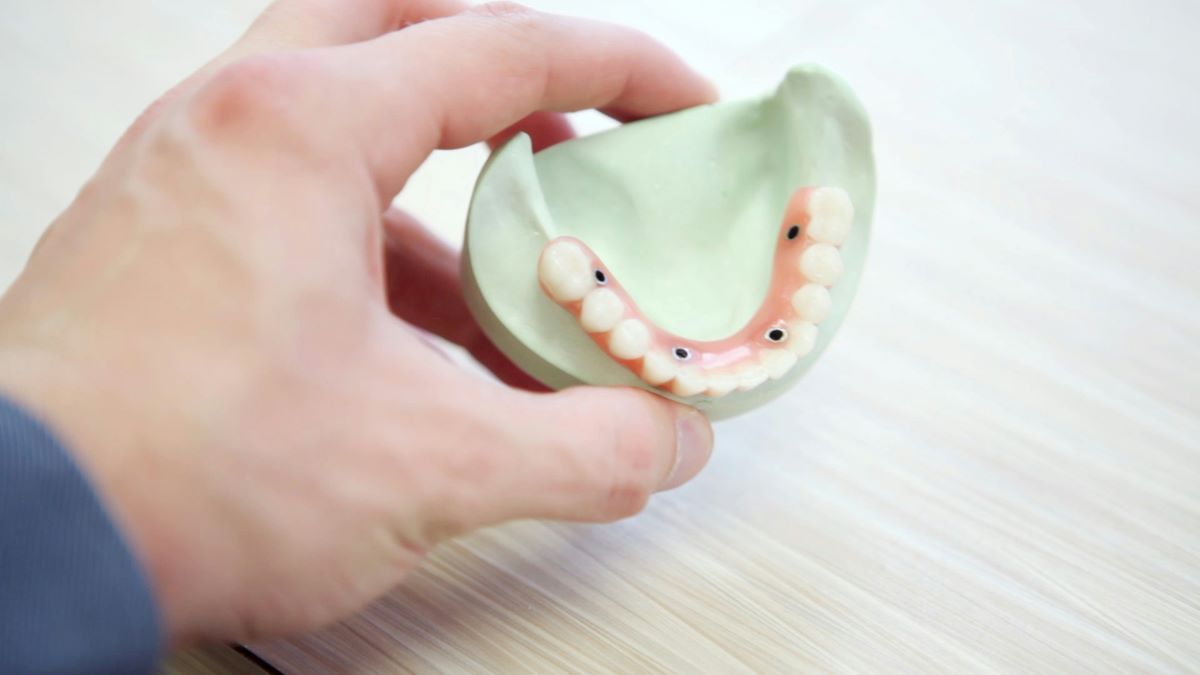 Snap-On Dentures