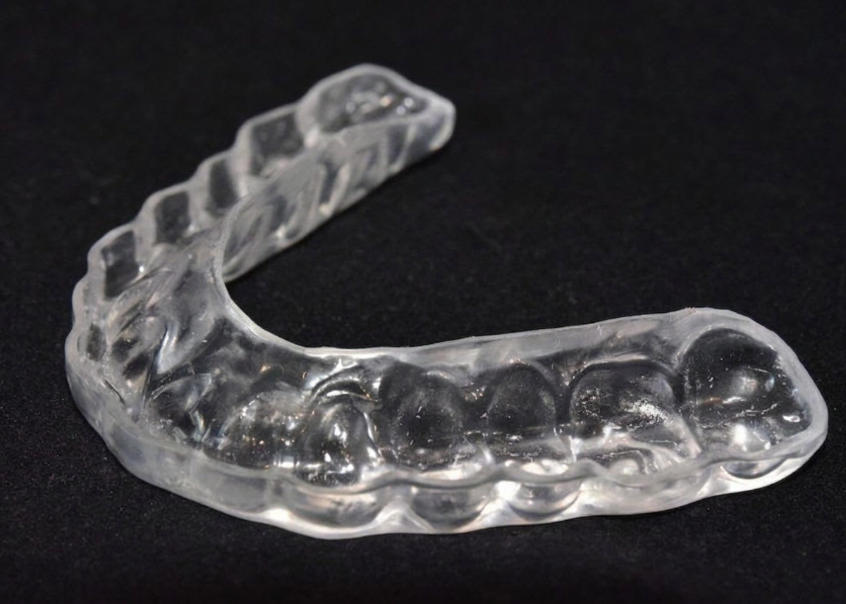TMJ / TMD Treatment Hamilton, custom-fabricated clear bite splint orthotic used in non-surgical TMJ therapy at Charlton Dentistry