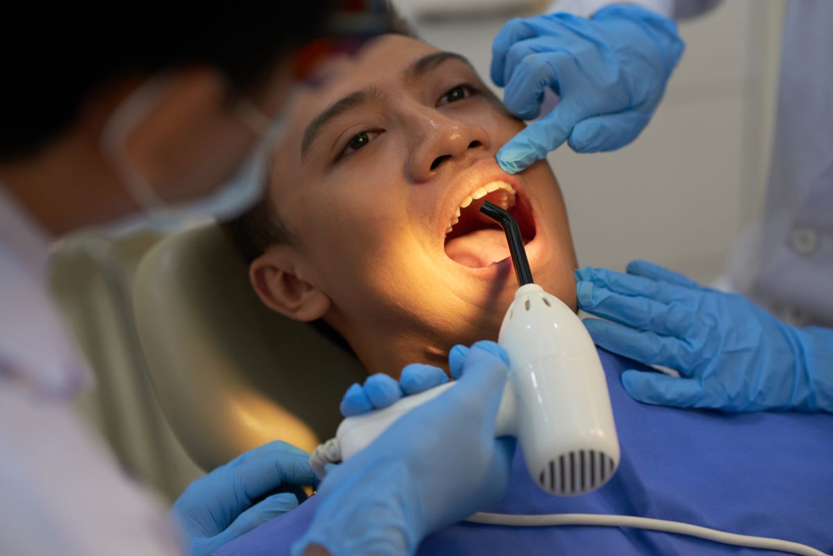 Tooth Fillings
